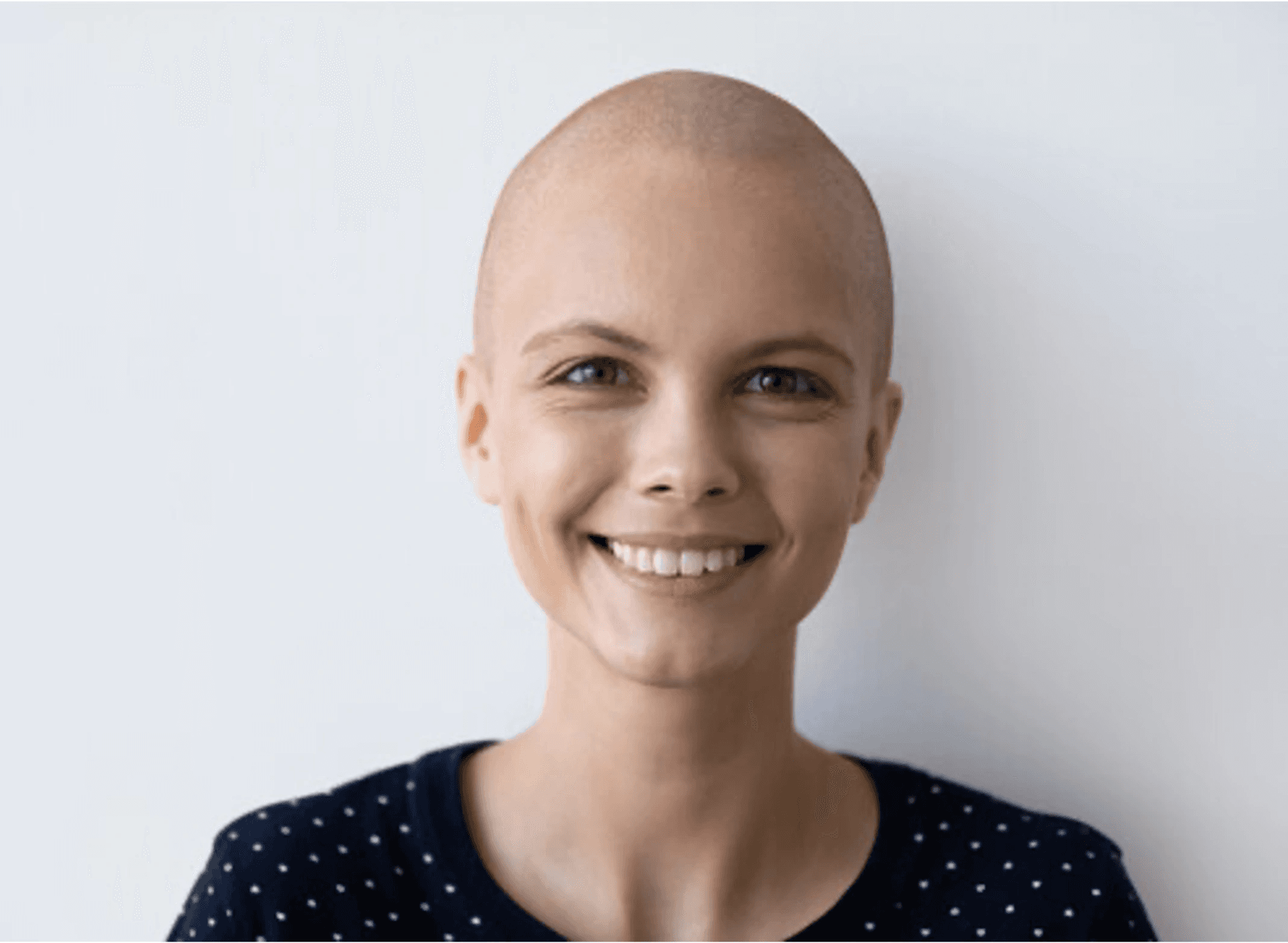 Before transformation 1